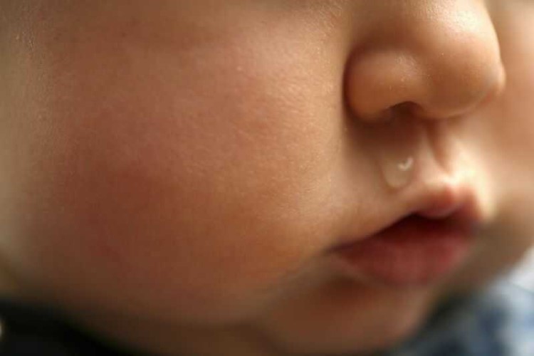 cách trị nghẹt mũi cho trẻ sơ sinh hiệu quả